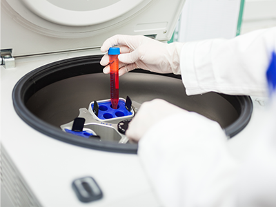 Méthode de la mesure de la température des centrifugeuses